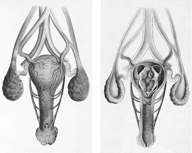 The female reproductive system, helpfully laid out as if it were the male reproductive system. Except for the tiny embarrassed fetus in the middle.