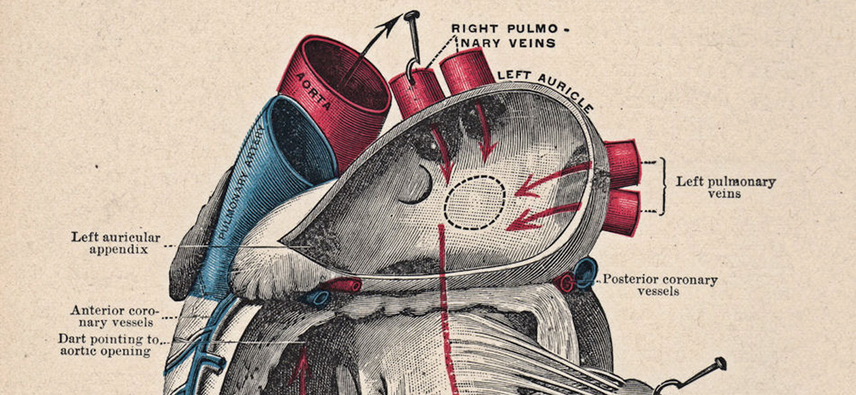 Blue Babies Big Egos And The Wild World Of Early Open Heart