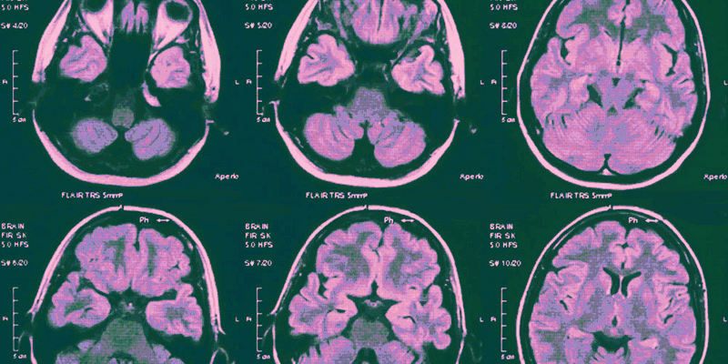 Towards A New Understanding of Psychosis and Violence